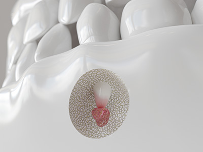 Platinum Endodontics | Cracked Teeth, Endodontic Retreatment and Apicoectomy