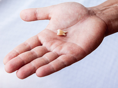 Platinum Endodontics | Endodontic Retreatment, Emergency Treatment and Apicoectomy